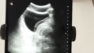 Ass Checkup - Anal Inspection with Doctor Reveals Secrets of Asshole