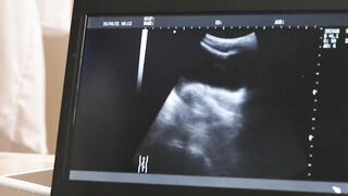 Doctor's Visit Turned Into A Threesome - MILF FFM Triple Play