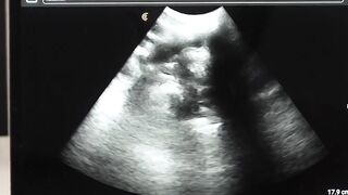 Legrand Wolf barebacks my ass during ultrasound exam
