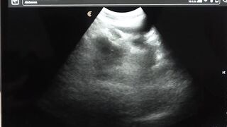 Legrand Wolf barebacks my ass during ultrasound exam