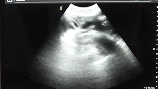 Legrand Wolf barebacks my ass during ultrasound exam