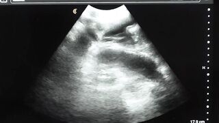 Legrand Wolf barebacks my ass during ultrasound exam