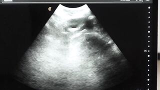 Legrand Wolf barebacks my ass during ultrasound exam