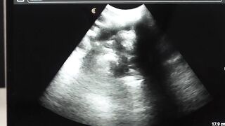 DILF Legrand Wolf barebacks me on the ultrasound table