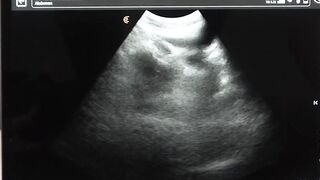 DILF Legrand Wolf barebacks me on the ultrasound table