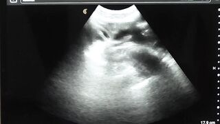 DILF Legrand Wolf barebacks me on the ultrasound table
