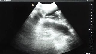 DILF Legrand Wolf barebacks me on the ultrasound table