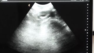 DILF Legrand Wolf barebacks me on the ultrasound table