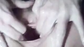 Mature Woman Prolapses Her Ass on Webcam