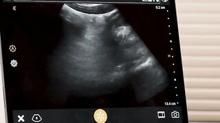My black twink patient wants my dick inside his ass