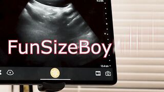 My black twink patient wants my dick inside his ass