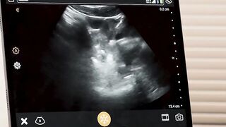 My black twink patient wants my dick inside his ass