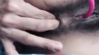 Hairy Milf Anal on Webcam