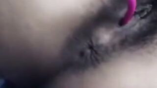 Hairy Milf Anal on Webcam