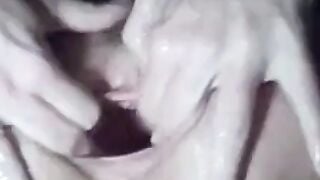 Mature Woman Prolapses Her Ass on Webcam Hoe 2
