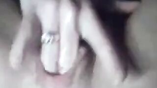 Mature Woman Prolapses Her Ass on Webcam Hoe 2