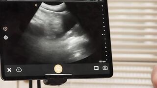 Fuckiny my friends ass while im duty in the clinic