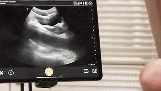 Fuckiny my friends ass while im duty in the clinic