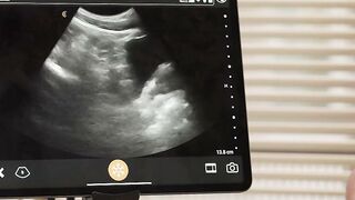 Horny doctor fucks his petite Twink patient