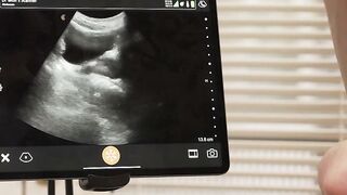 Horny doctor fucks his petite Twink patient
