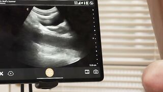 Fucking my well patient in his tight ass