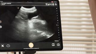 Fucking my well patient in his tight ass