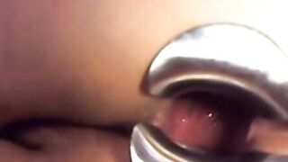 Webcam Girl Anal Play with Dildo and Speculum