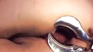 Webcam Girl Anal Play with Dildo and Speculum