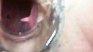 Amateur Webcam Girl Shows Hairy Vagina Close Up