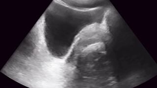 Doctors Ultrasound Breeding Session