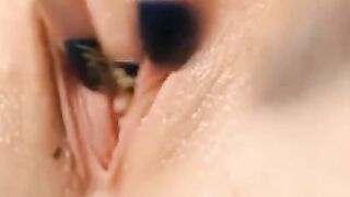Super Lips: Amateur Medical Webcam Close-Up