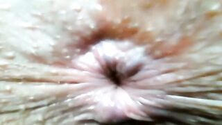 Hairy Camgirl Shows Off Her Tight Asshole On Webcam Close Up
