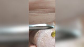 Bizarre Wasp CBT Insertion Extreme Fetish Anal Play