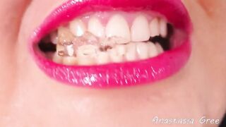 Sharpest teeth Insane close up #12